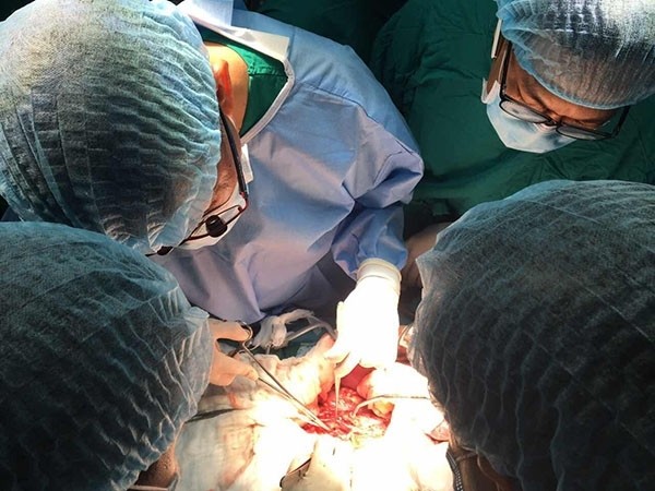L’équipe des médecins de l’hôpital Cho Rây mène une transplantation d’organes. Photo: NDEL.