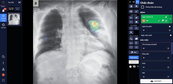 « DrAid » est capable de détecter et de dépister plus de 21 signes anormaux et pathologies de Poumon - Coeur - Os en 5 secondes avec une précision de plus de 89%. Photo : BC.